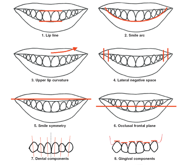 Perfect Smile diagram