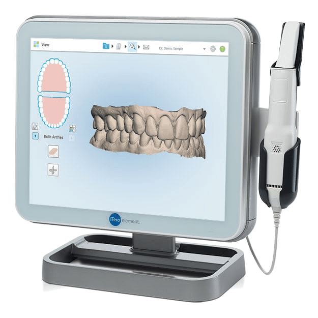 A iTero scanner system with a computer. The screen displays a scan of someone's teeth.