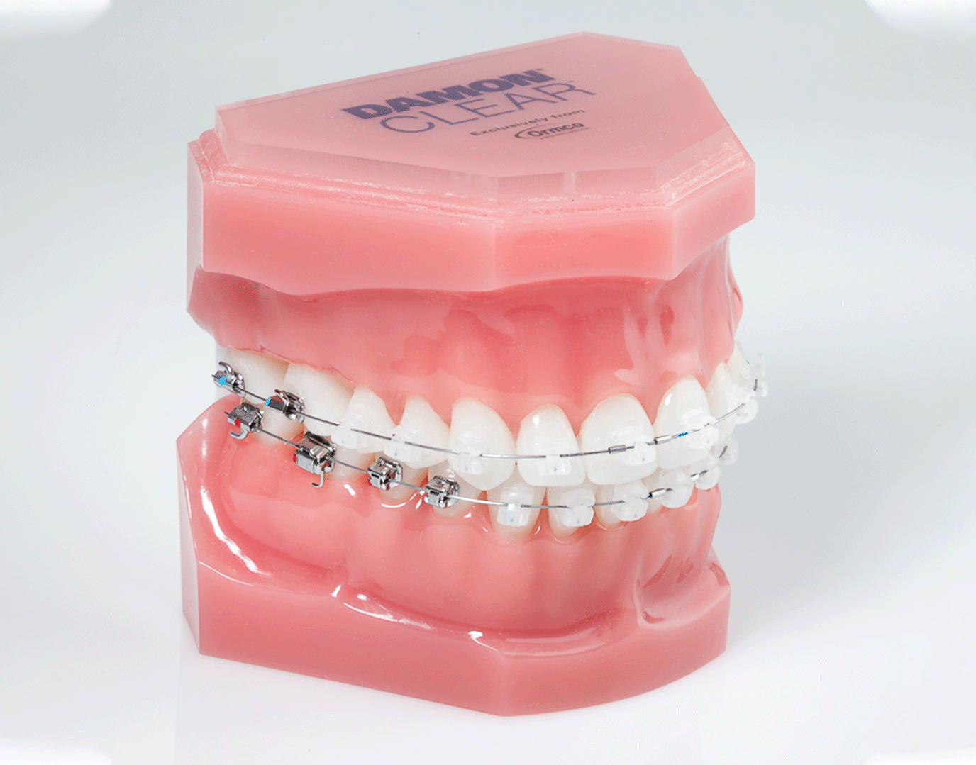 A model of teeth with Damon Clear braces.