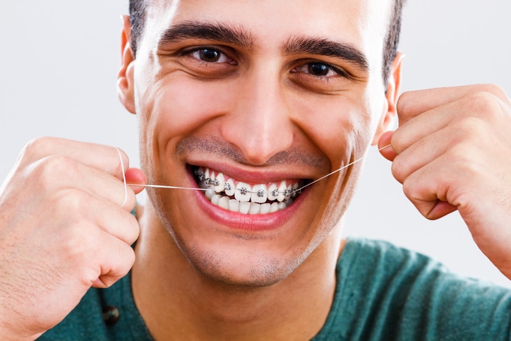 A man smiling with braces on his top teeth only. He is flossing his teeth.