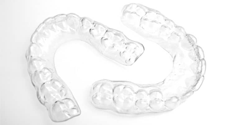 A photo of a pair of clear aligners.