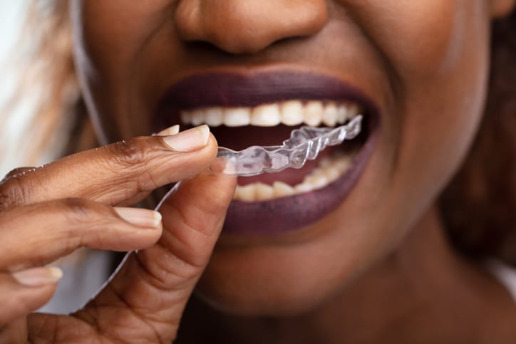 A woman with berry lipstick applying a clear aligner tray.