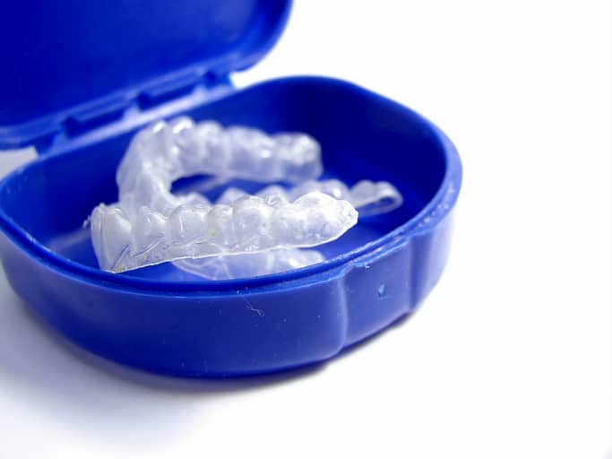 A pair of clear aligners in a blue storage case.