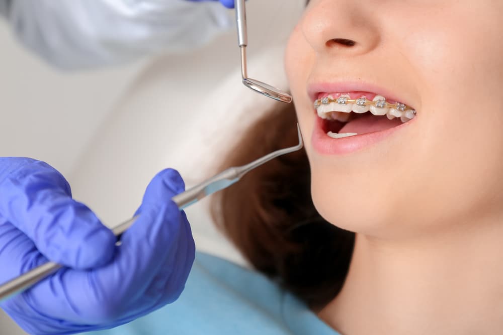 Close up of an orthodontist cleaning a teen girl's braces with a mirror and a pick.